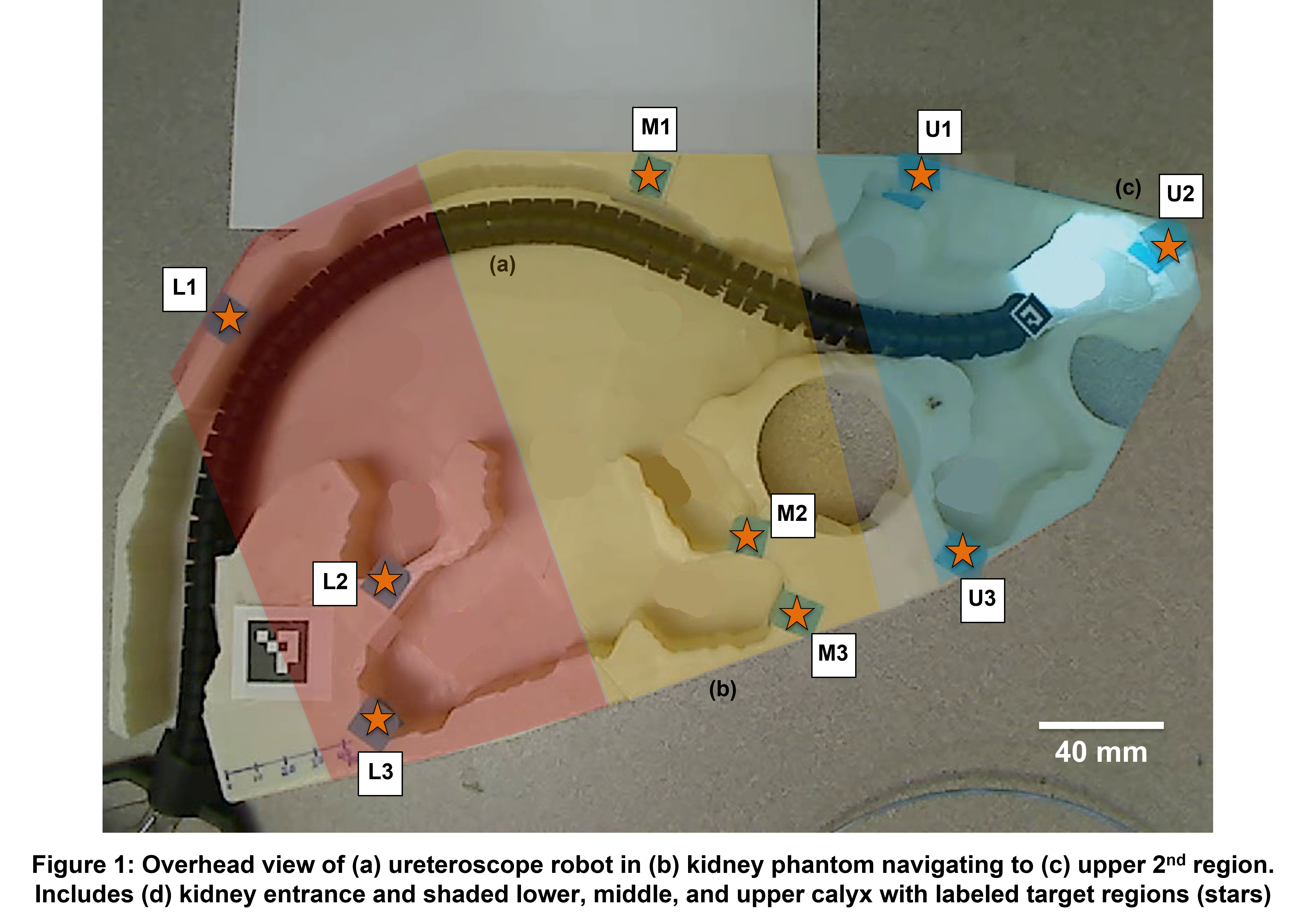 urétéroscope robotisé montage expérimental vue de dessus